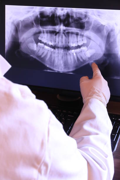 Best Knocked-Out Tooth (Avulsed Tooth) Treatment in Folsom, CA