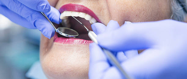Best Emergency Cosmetic Dentistry (e.g., broken veneers) in Folsom, CA